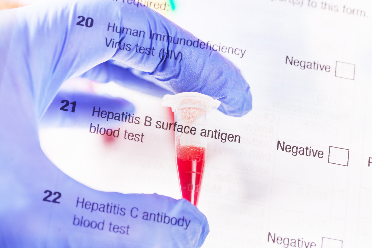 blood sample on tubes with medical exam options
